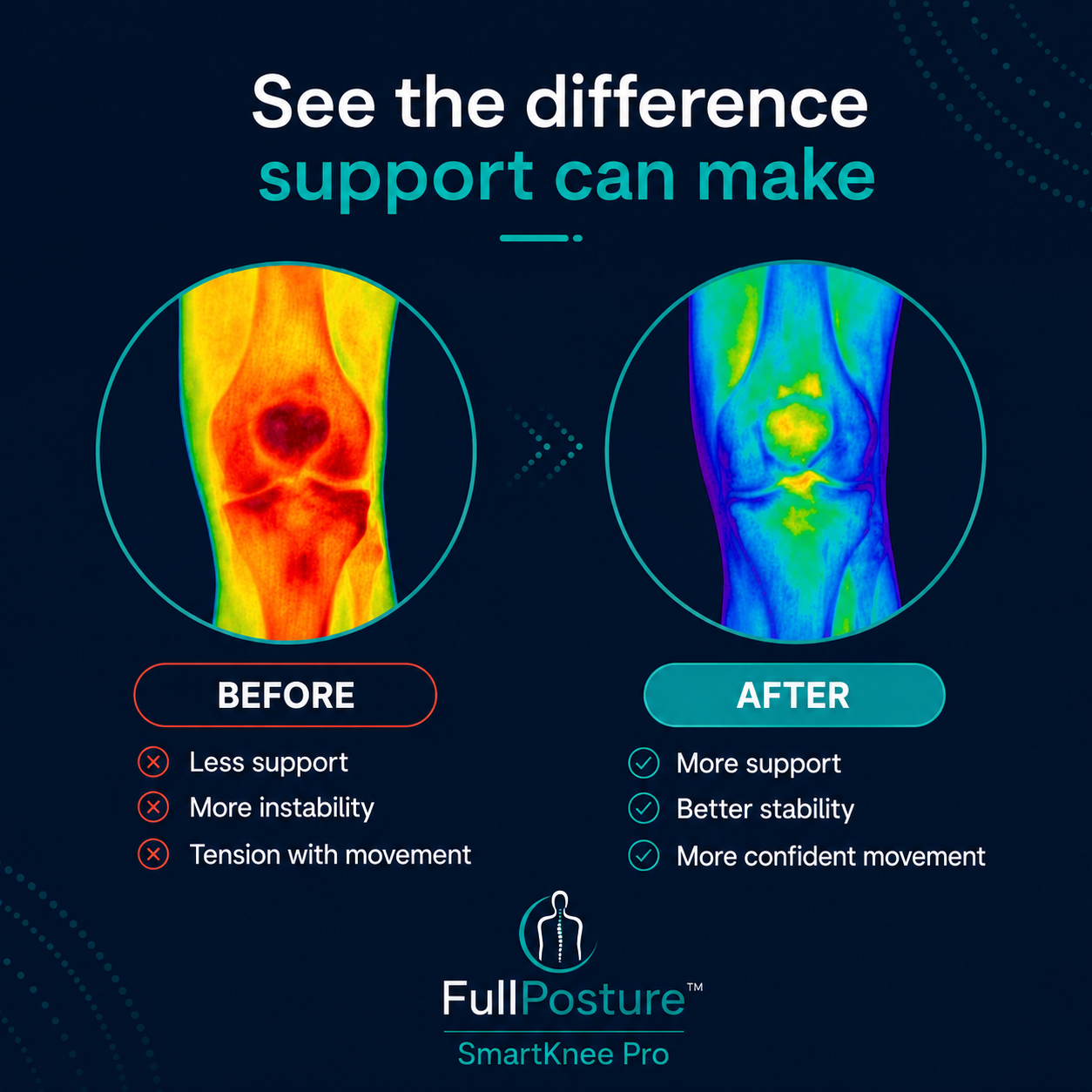 FullPosture™ SmartKnee Pro Support Brace